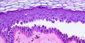 Nuovo farmaco orale contro il pemfigo