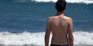 Epidermolisi bollosa: terapia genica e staminali salvano un bambino di 9 anni